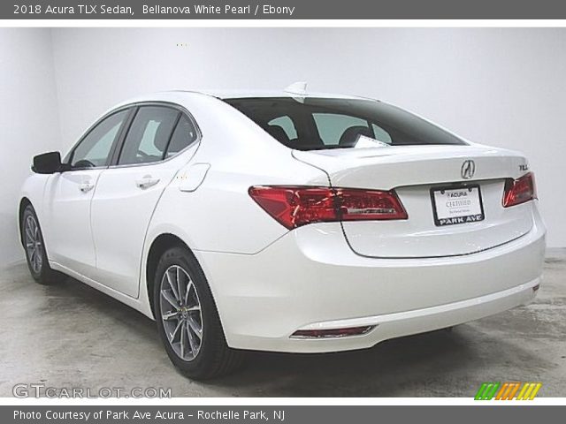 2018 Acura TLX Sedan in Bellanova White Pearl
