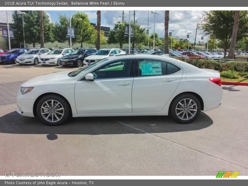 Bellanova White Pearl / Ebony 2018 Acura TLX Technology Sedan