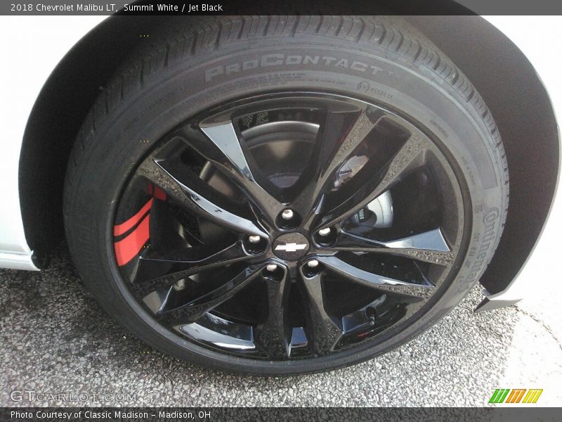 Summit White / Jet Black 2018 Chevrolet Malibu LT
