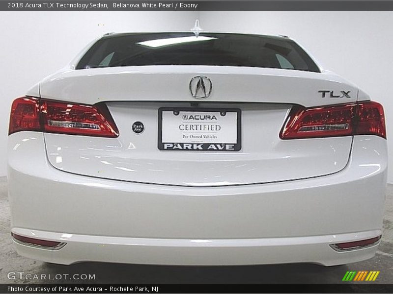 Bellanova White Pearl / Ebony 2018 Acura TLX Technology Sedan