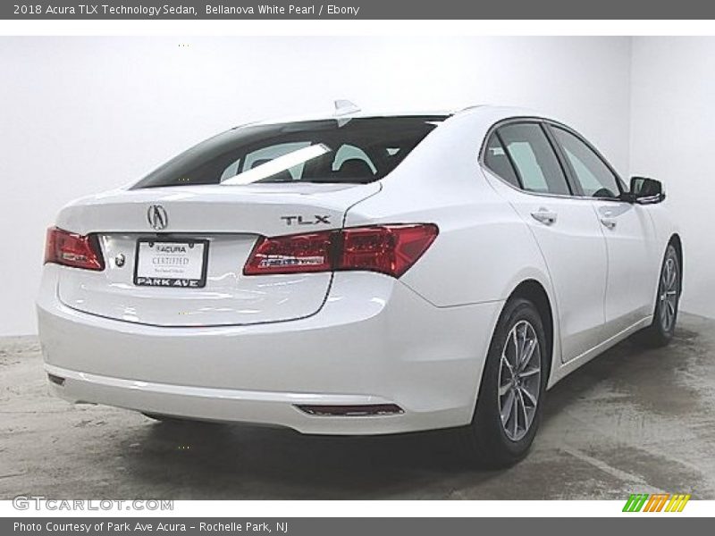 Bellanova White Pearl / Ebony 2018 Acura TLX Technology Sedan