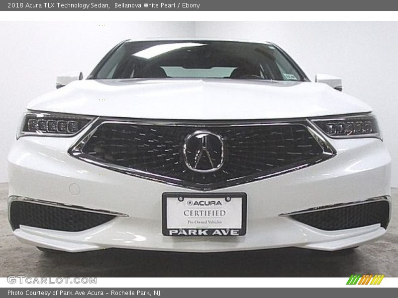 Bellanova White Pearl / Ebony 2018 Acura TLX Technology Sedan