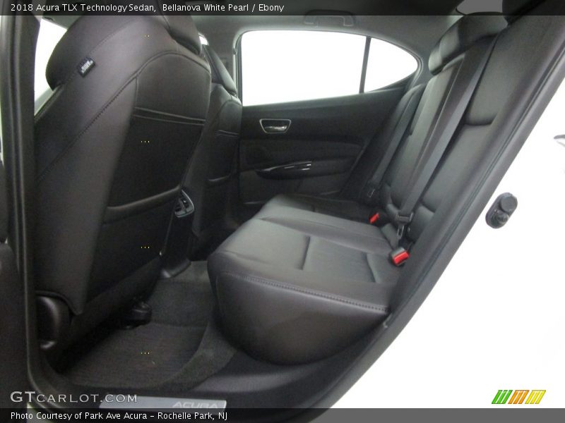 Bellanova White Pearl / Ebony 2018 Acura TLX Technology Sedan