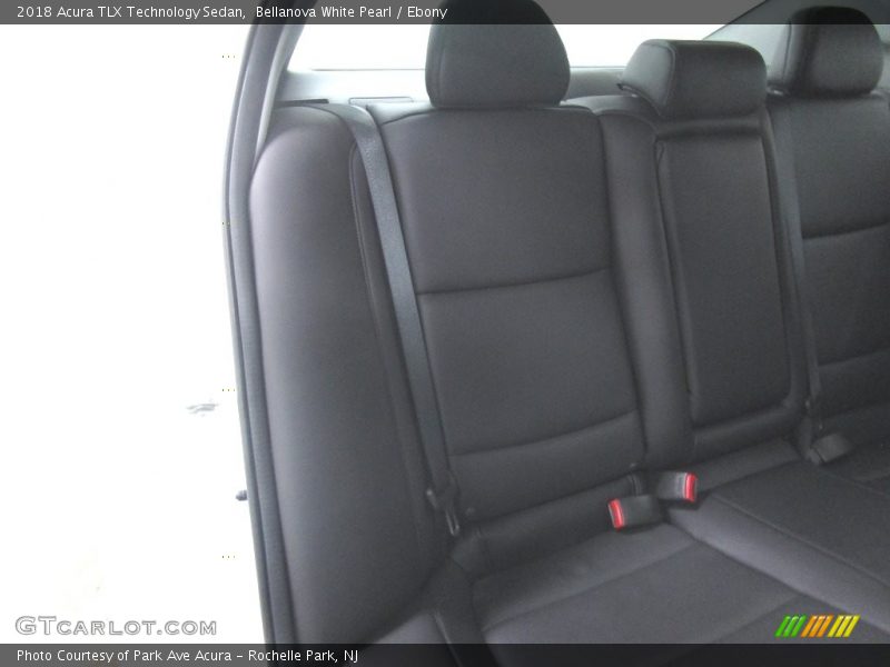 Bellanova White Pearl / Ebony 2018 Acura TLX Technology Sedan