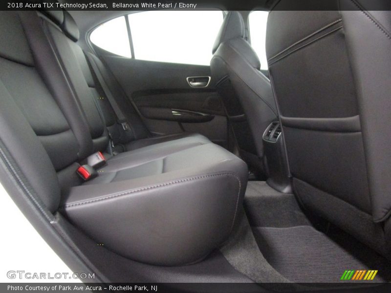 Bellanova White Pearl / Ebony 2018 Acura TLX Technology Sedan
