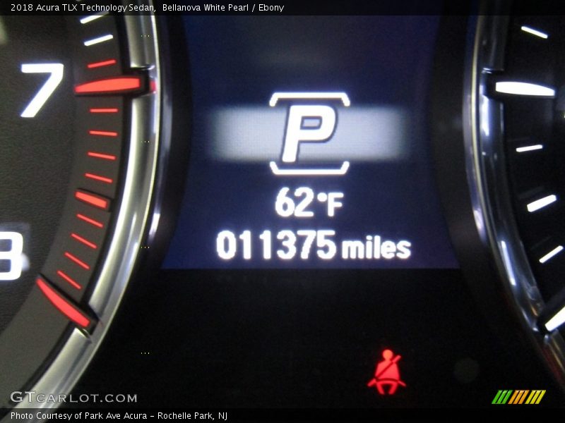 Bellanova White Pearl / Ebony 2018 Acura TLX Technology Sedan