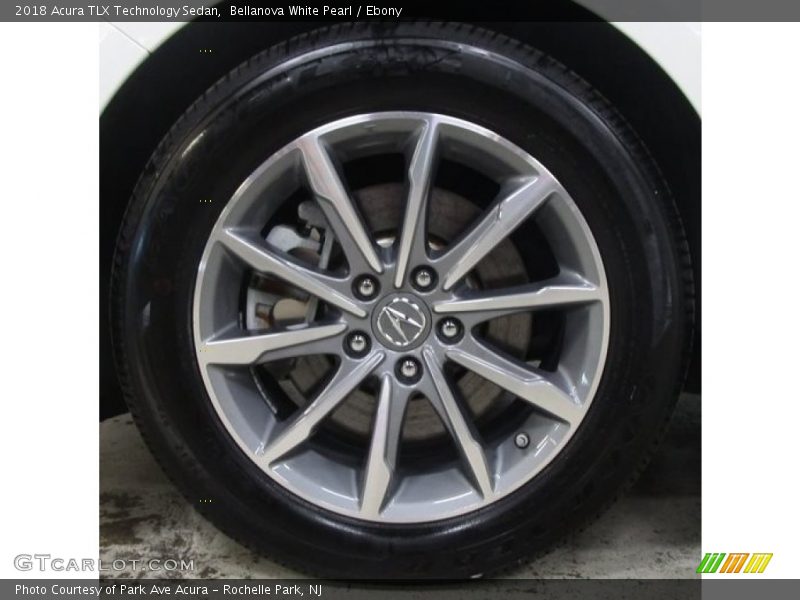 Bellanova White Pearl / Ebony 2018 Acura TLX Technology Sedan
