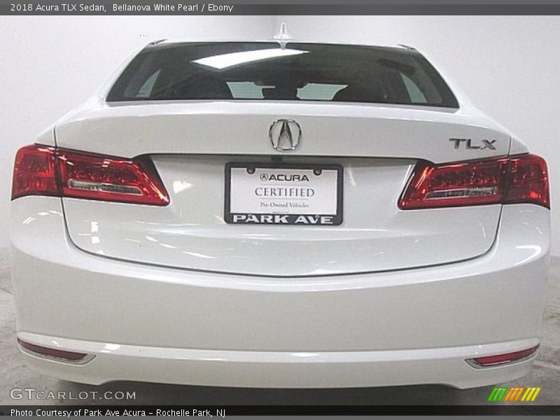 Bellanova White Pearl / Ebony 2018 Acura TLX Sedan