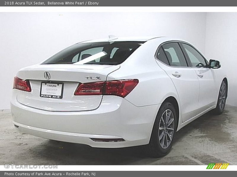 Bellanova White Pearl / Ebony 2018 Acura TLX Sedan