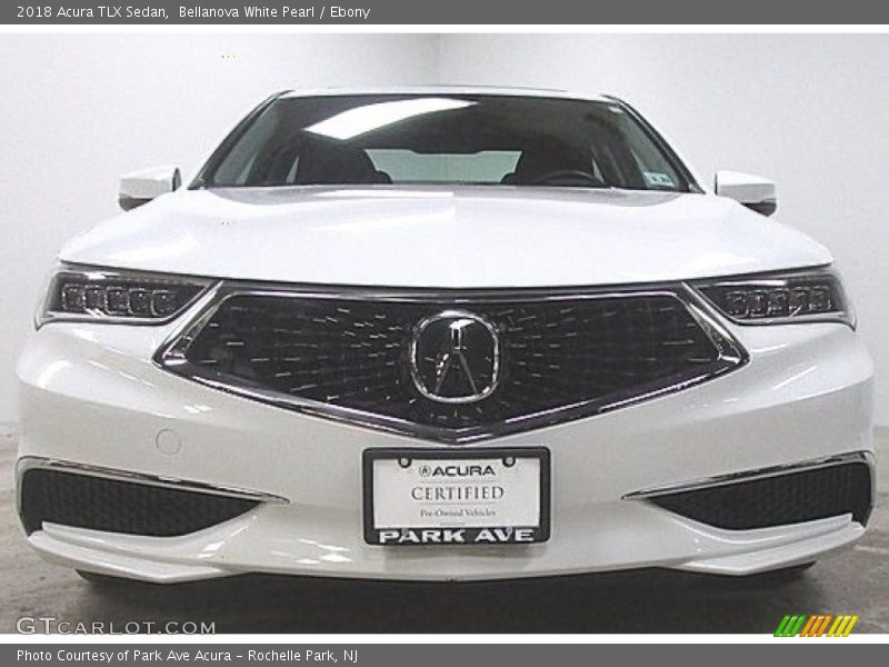 Bellanova White Pearl / Ebony 2018 Acura TLX Sedan
