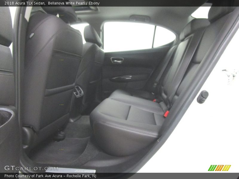 Bellanova White Pearl / Ebony 2018 Acura TLX Sedan