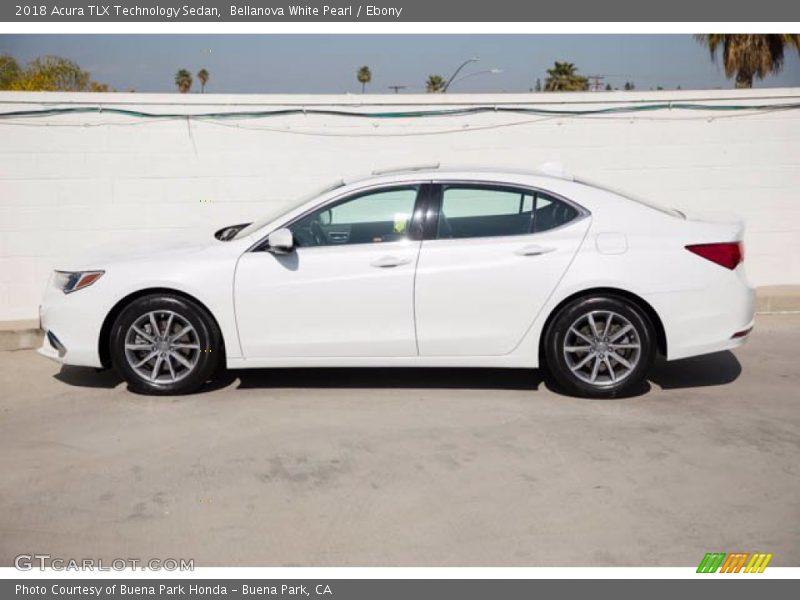 Bellanova White Pearl / Ebony 2018 Acura TLX Technology Sedan