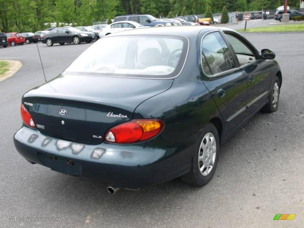 2000 Elantra GLS Sedan - Forest Green / Beige photo #4