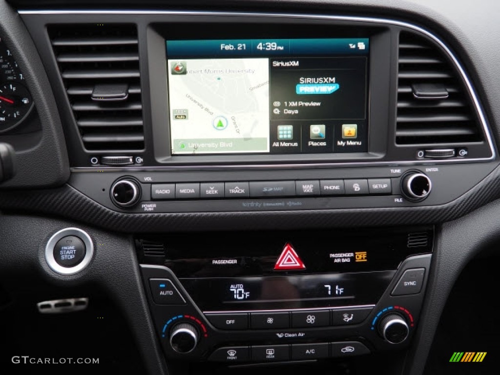 2017 Hyundai Elantra Sport Controls Photo #118993029