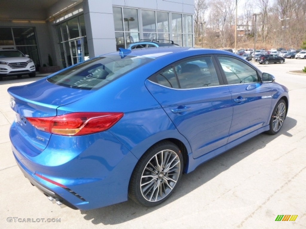 2017 Elantra Sport - Electric Blue / Black photo #2