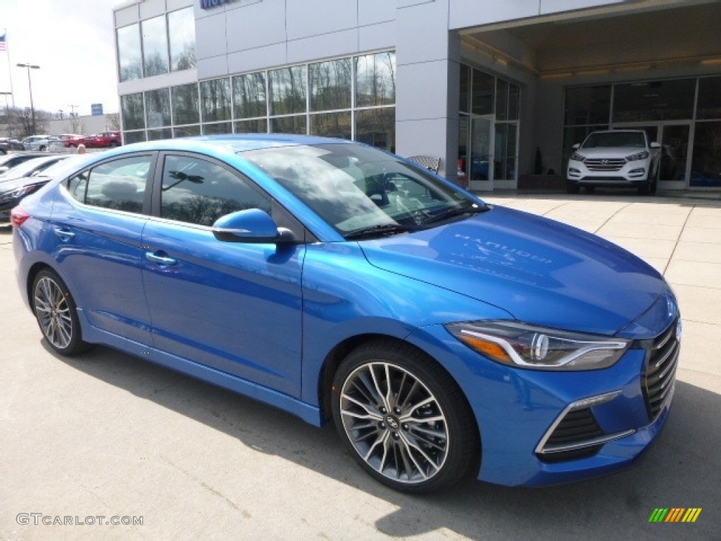 2017 Hyundai Elantra Sport Exterior Photos
