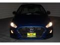 Electric Blue - Sonata SE Photo No. 2