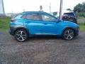 2018 Surf Blue Hyundai Kona Limited  photo #3