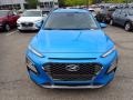 2021 Surf Blue Hyundai Kona Ultimate AWD  photo #4