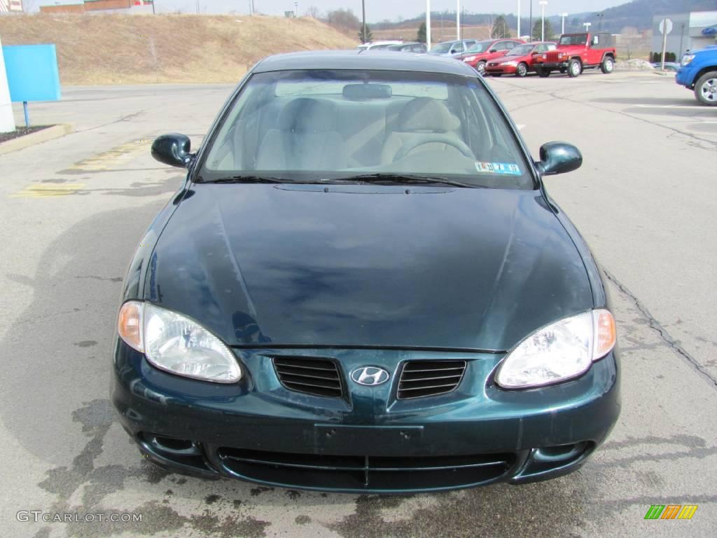 2000 Elantra GLS Sedan - Forest Green / Beige photo #10