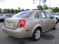 Champagne Beige Metallic - Forenza  Photo No. 7