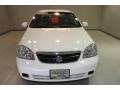 2008 Absolute White Suzuki Forenza   photo #2