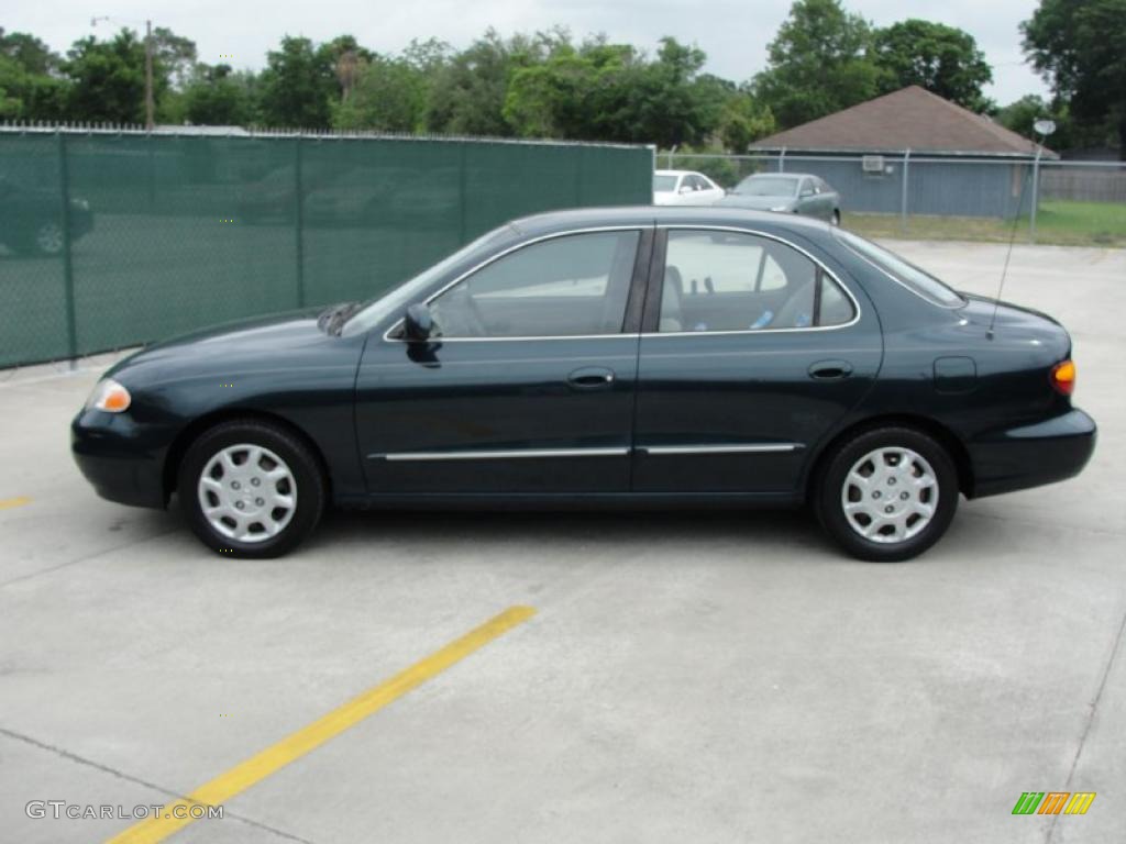 2000 Elantra GLS Sedan - Forest Green / Gray photo #6
