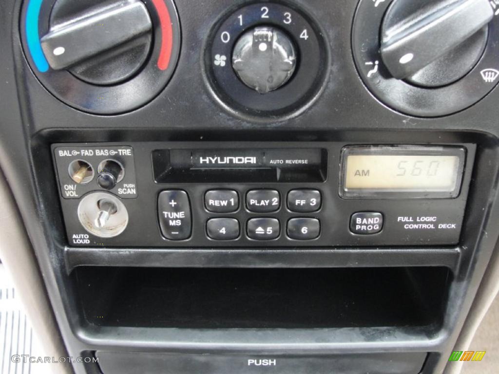 2000 Elantra GLS Sedan - Forest Green / Gray photo #36