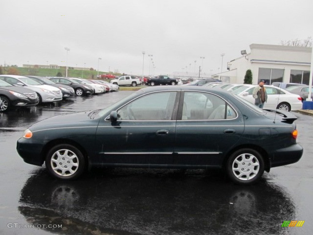 2000 Elantra GLS Sedan - Forest Green / Beige photo #6
