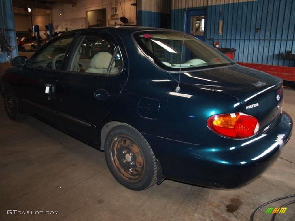 2000 Elantra GLS Sedan - Forest Green / Beige photo #3