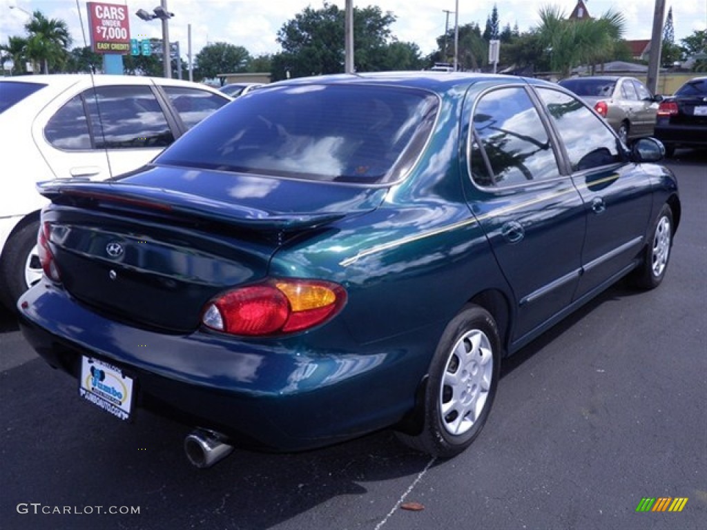 2000 Elantra GLS Sedan - Forest Green / Gray photo #10