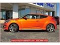 Vitamin C - Veloster Turbo Photo No. 2